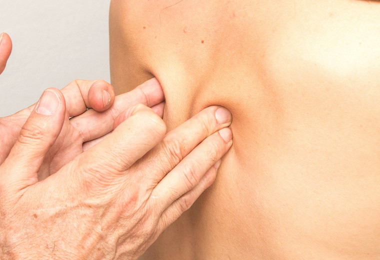 Fisioterapia Deportiva